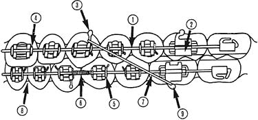 Ligature-Image